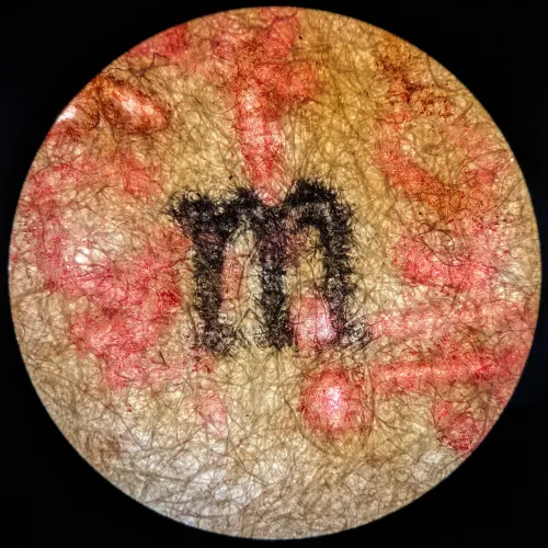 Microtype #03